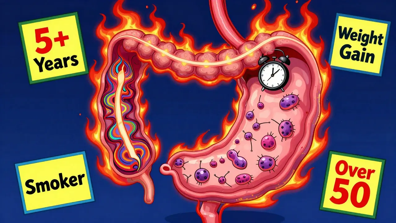 Esophageal Cancer Risk: Chronic GERD and the Red Flags You Can't Ignore